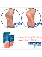 Kem phục hồi da chân và trị nứt nẻ gót chân 10% Urea Nivelazione